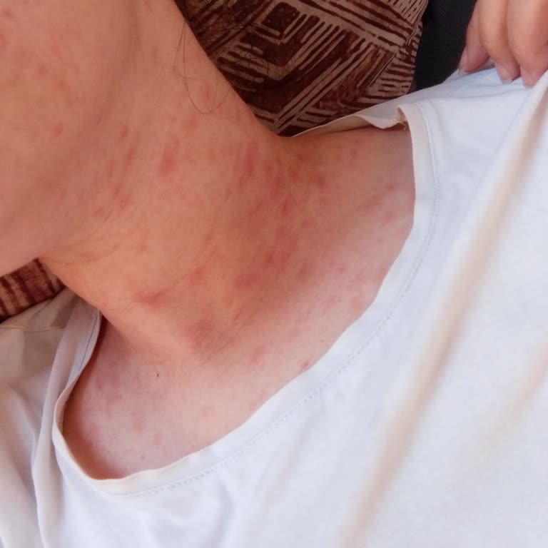 Yanlış Teşhis Ve Tedavi: Sağlığım Tehlikeye Atıldı