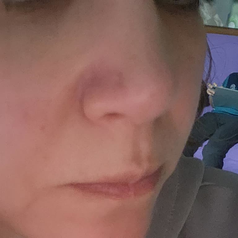 Ameliyat Sonrası Hayal Kırıklığı Ve Çözüm Bulunamaması