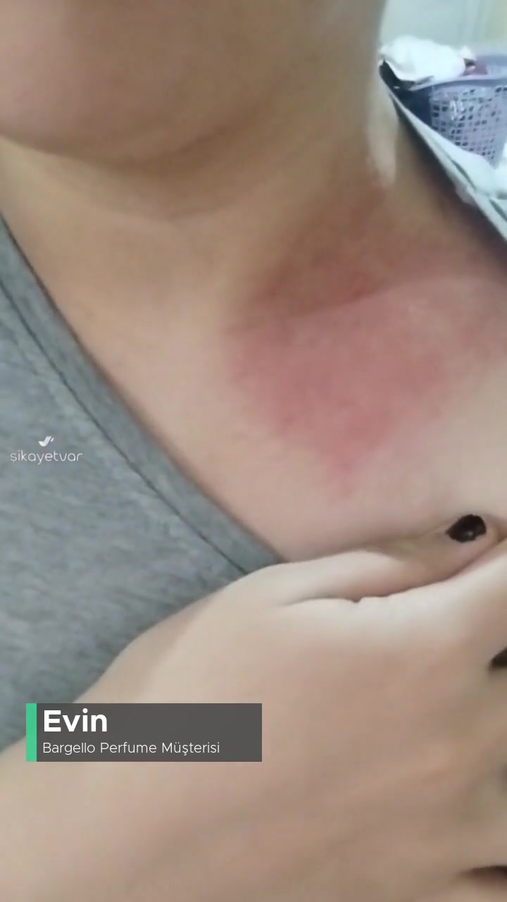 Bargello Perfume 122 Alerji Yaptı videonun kapak resmi