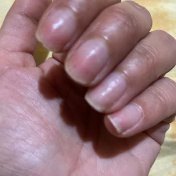 Kalıcı Oje Çıkarma İşleminde Yaşanan Sorunlar Ve Tırnak Hasarı