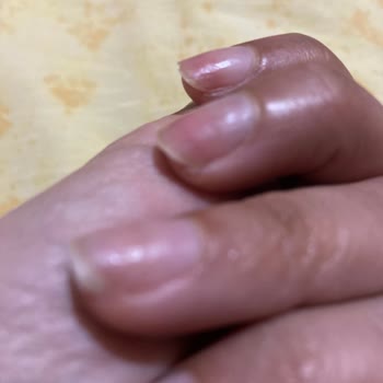 Kalıcı Oje Çıkarma İşleminde Yaşanan Sorunlar Ve Tırnak Hasarı