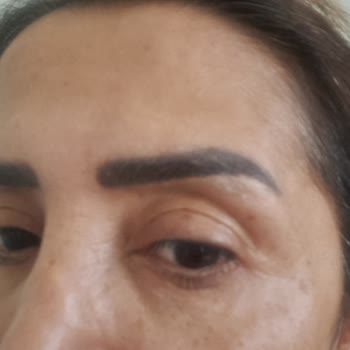 Eki aç