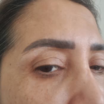 Eki aç