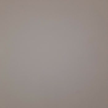 Destek Hatası Ve Eksik Bakiye Sorunu