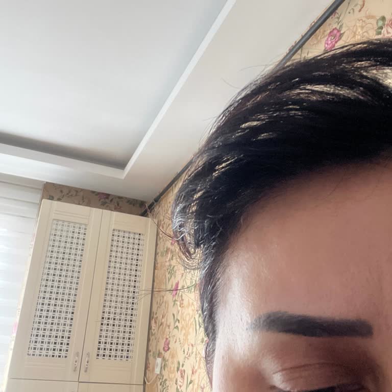 Gözaltında Alerji Ve Şişlik Sorunu