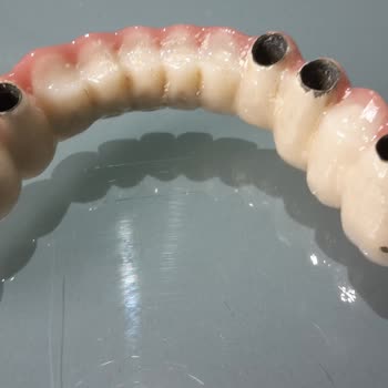 Dentaydın'da Zincirleme Kaza: İmplant Ve Protez Kabusu