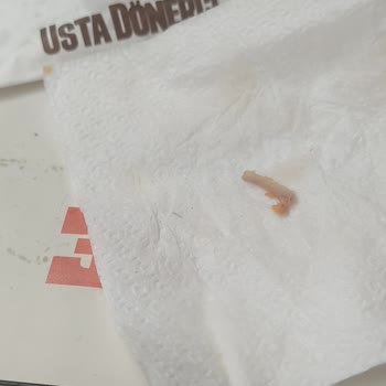 Yemekte Tehlikeli Kemik Parçaları