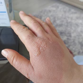 Contigo Termosun Tehlikeli Sızıntı Problemi