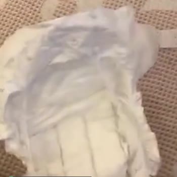 Sleepy 6 Numara Çırtlı Bebek Bezi Kopuk Çıkıyor!