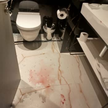 Gönen Hotels Otelin İhmalkarlığı Sonucu Yaralandım Destek Alamadım