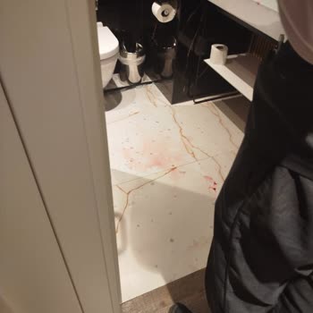 Gönen Hotels Otelin İhmalkarlığı Sonucu Yaralandım Destek Alamadım