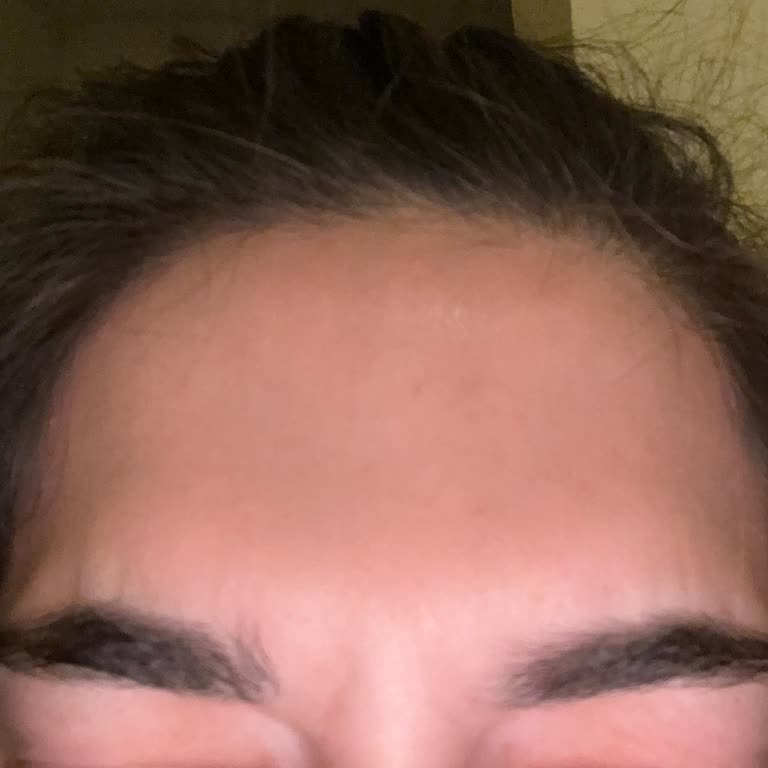 British Esthetic Başarısız Estetik Deneyimi