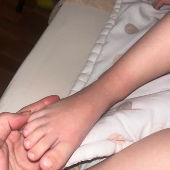 Argivit Focus Kullanımı Sonrası Sağlık Sorunları