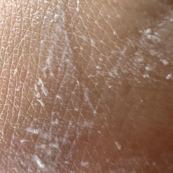 Gratis Güneş Koruyucudaki Rahatsız Edici Maddeler!