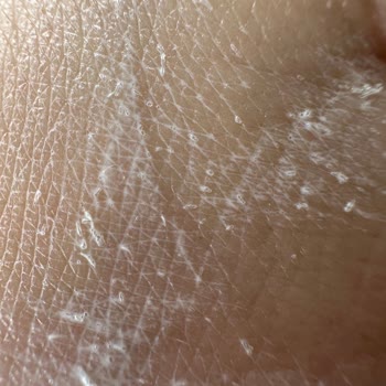 Gratis Güneş Koruyucudaki Rahatsız Edici Maddeler!