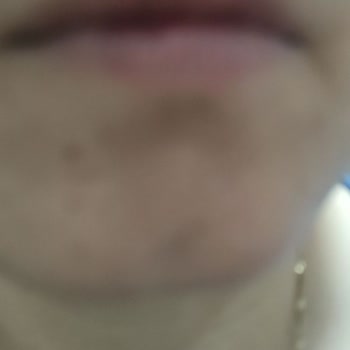 Bozuk Ürün Ve İade Sorunu Yaşadım