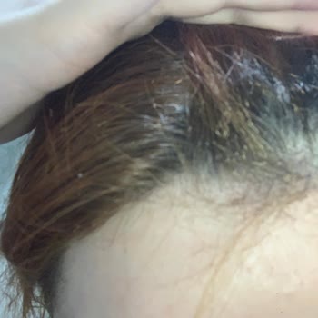 Fantom Jolie Düzleştirici Saçlarımı Yaktı!