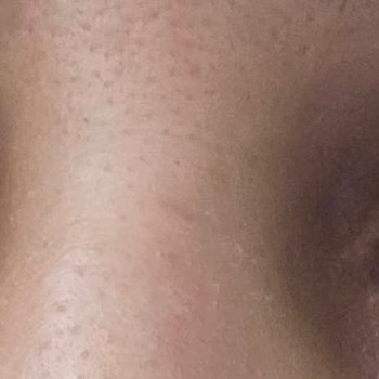 Lausel Lens Yanlış Ve Kalitesiz Lens Gönderimi