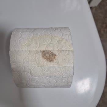 Hijyenik Olmayan Tuvalet Kağıdı Şoku