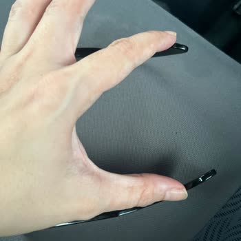 Atasun'da Gözlük Ayarlama Sorunu Ve Kötü Müşteri Hizmeti