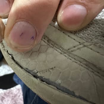 Skechers Ayakkabıda Beklenmedik Açılma Ve Olumsuz İade Deneyimi