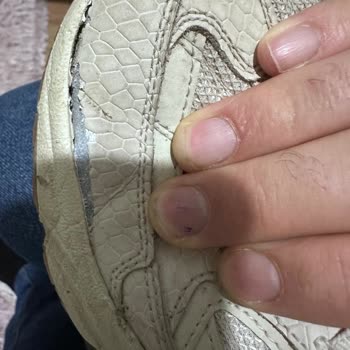 Skechers Ayakkabıda Beklenmedik Açılma Ve Olumsuz İade Deneyimi