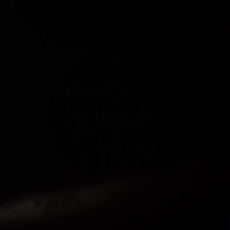 Peptit Ve Göz Kremi Sivilce Sorunu