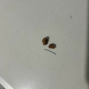 Fellas High Bar'da Sağlık Riski: İp Parçası Şoku