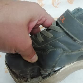 FLO Çocuk Ayakkabısında Erken Deformasyon Ve Müşteri Hizmetleri Hayal Kırıklığı