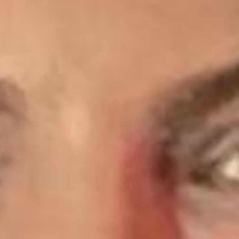 Duygu Demirkan Botoks Mağduriyeti