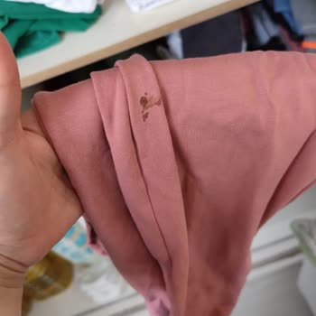 Siemens Ev Aletleri Pas Lekeleri Ve İlgisiz Hizmetle Mağduriyet