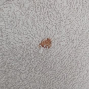 Siemens Ev Aletleri Pas Lekeleri Ve İlgisiz Hizmetle Mağduriyet