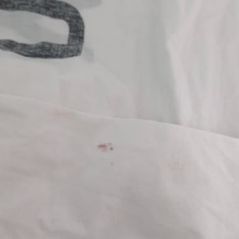 Siemens Ev Aletleri Pas Lekeleri Ve İlgisiz Hizmetle Mağduriyet