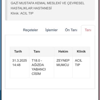 Yemekte Tahta Parçası Şoku