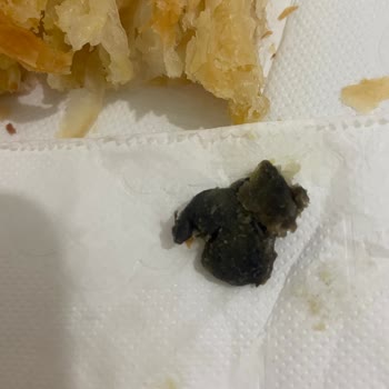 Şok Marketler Çıtırtat İçinden Yabancı Madde Çıktı