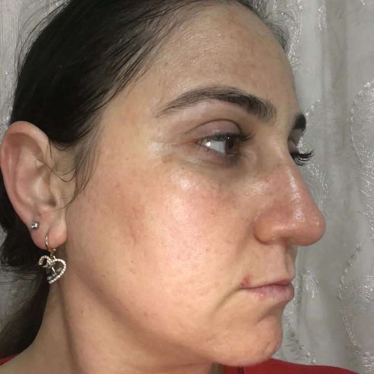 Cilt Bakımında Hayal Kırıklığı: İlgisizlik Ve Artan Lekeler