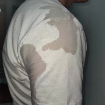 Su Geçirmez Mont Hayal Kırıklığı