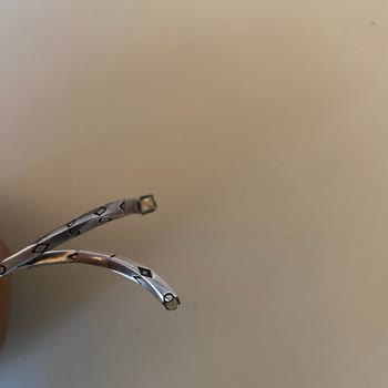 Garanti Kapsamında Olmayan Kırık Bileklik Sorunu