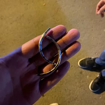 Garanti Kapsamında Olmayan Kırık Bileklik Sorunu