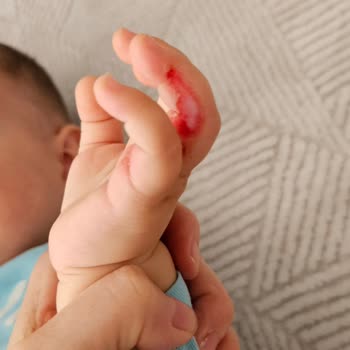 Yanlış Ürün Ve Güvenlik Sorunu: Bebeğimin Parmakları Tehlikede