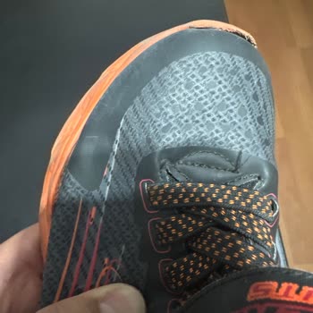 Skechers Ayakkabıda Beklenmedik Sorunlar