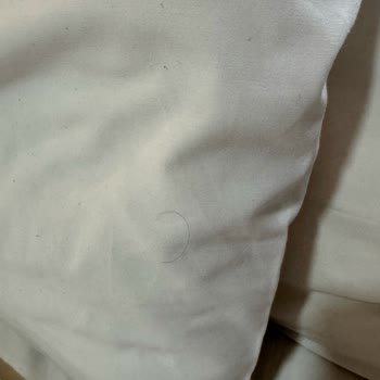 Obilet Üzerinden Yapılan Rezervasyonda Hijyen Ve Güvenlik Sorunları