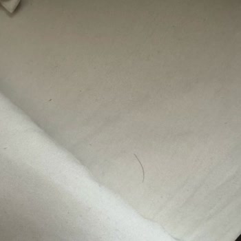 Obilet Üzerinden Yapılan Rezervasyonda Hijyen Ve Güvenlik Sorunları