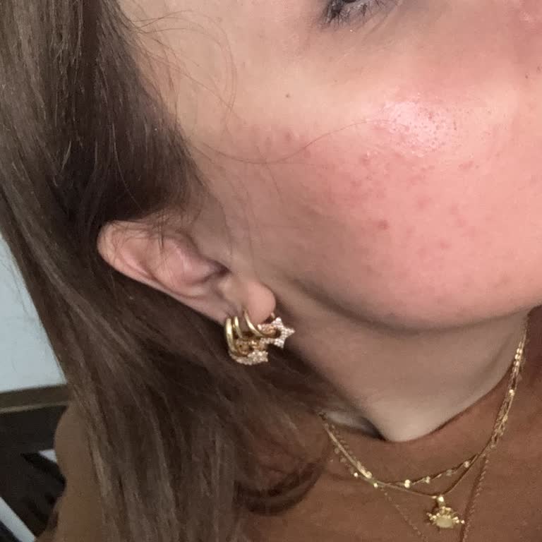 Yves Rocher Sebo Pure Vegetal Ürünleri Cildimde Sorun Yarattı