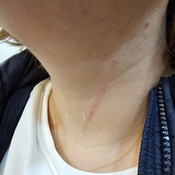 Buca Belediyesi Saldırgan Sokak Köpekleri Güvenliğimizi Tehdit Ediyor