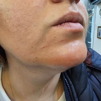 Buca Belediyesi Saldırgan Sokak Köpekleri Güvenliğimizi Tehdit Ediyor