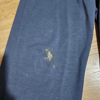 Buca Belediyesi Saldırgan Sokak Köpekleri Güvenliğimizi Tehdit Ediyor