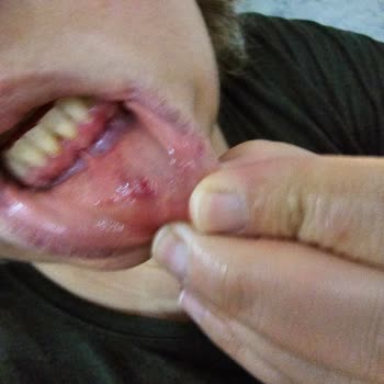 Buca Belediyesi Saldırgan Sokak Köpekleri Güvenliğimizi Tehdit Ediyor