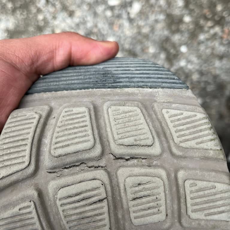 Skechers Ayakkabıda Yırtılma Ve İlgisiz Müşteri Hizmetleri