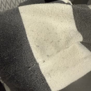 H&M Kazak Kalitesi Ve Müşteri Hizmetleri Hayal Kırıklığı